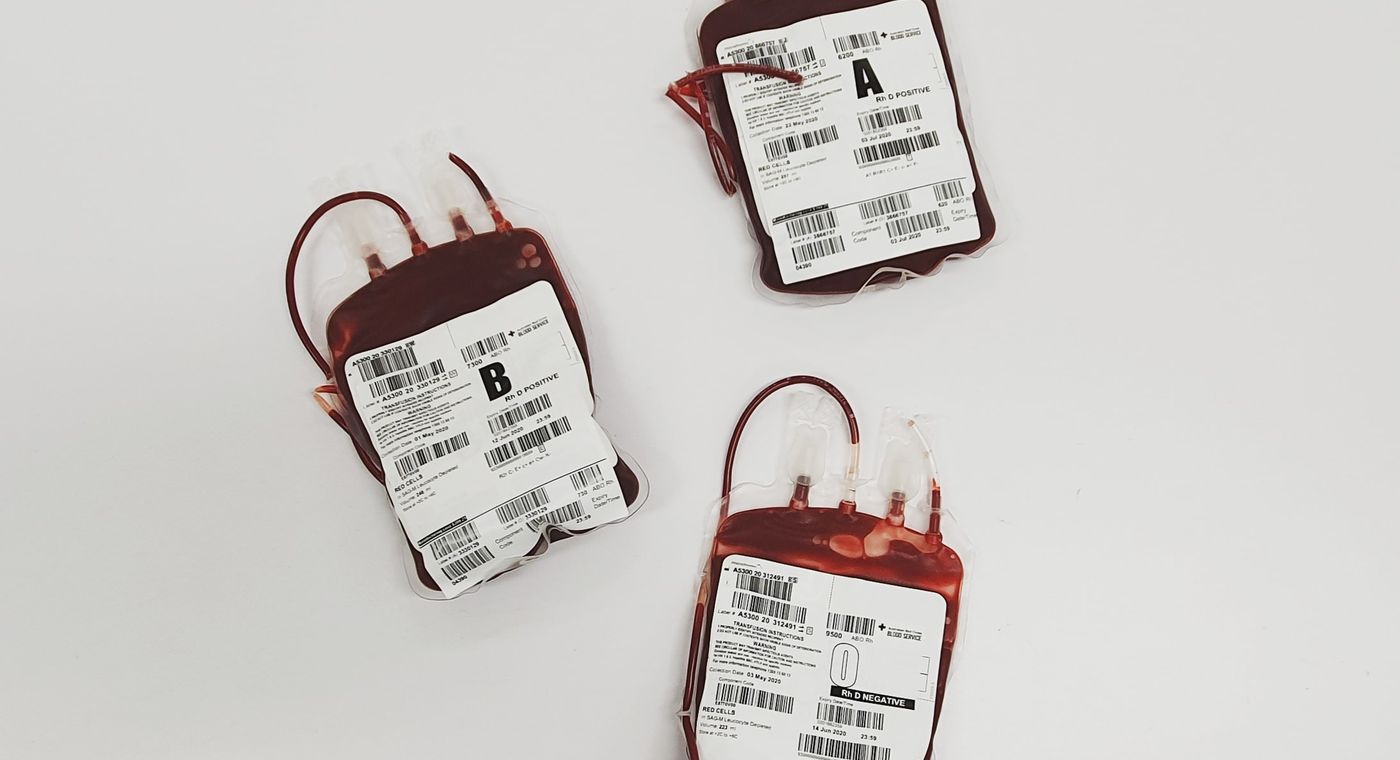 Three labeled units of red cells on a white surface showing A Rh D positive, B Rh D positive and O Rh D negative blood group labels